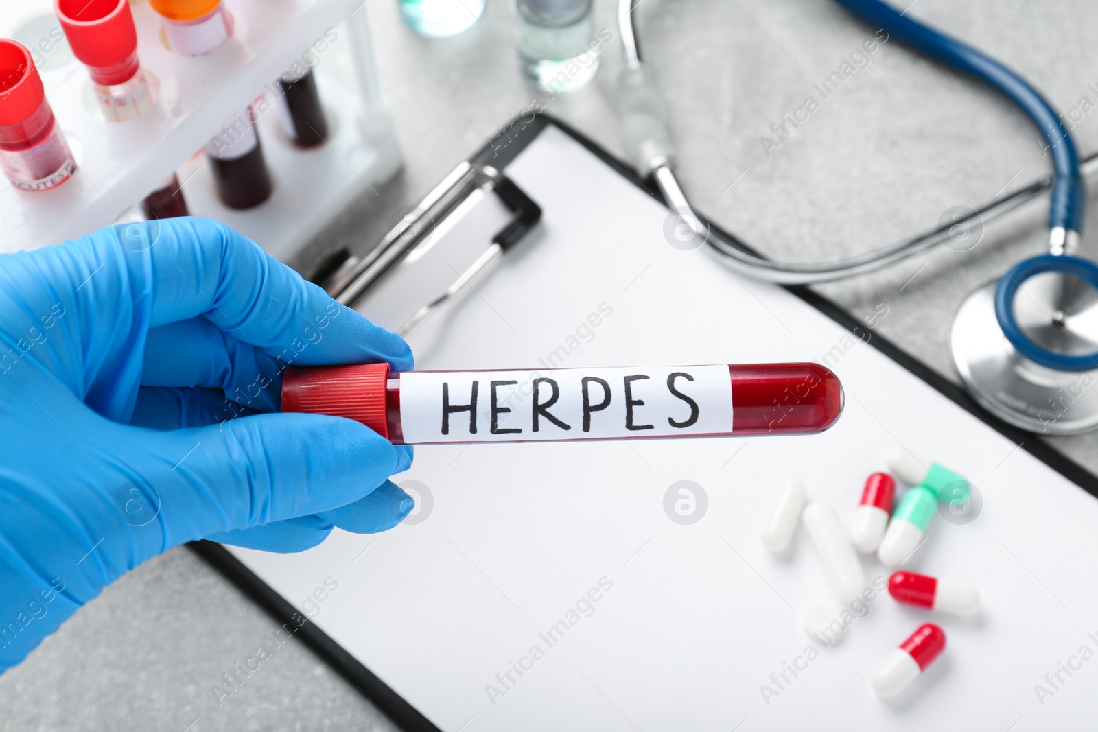 Photo of Doctor in glove holding test tube with word Herpes above light grey table, closeup