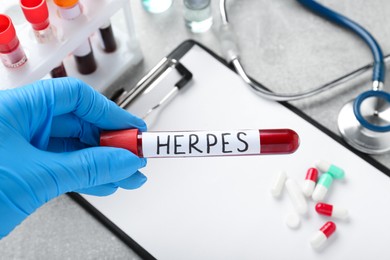 Doctor in glove holding test tube with word Herpes above light grey table, closeup