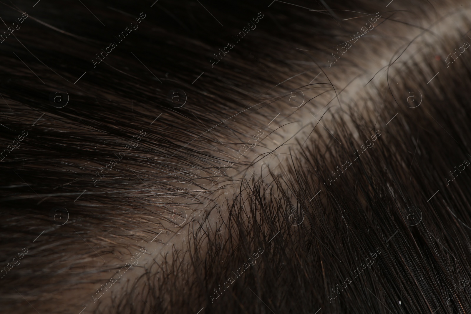 Photo of Man with healthy dark hair, macro view