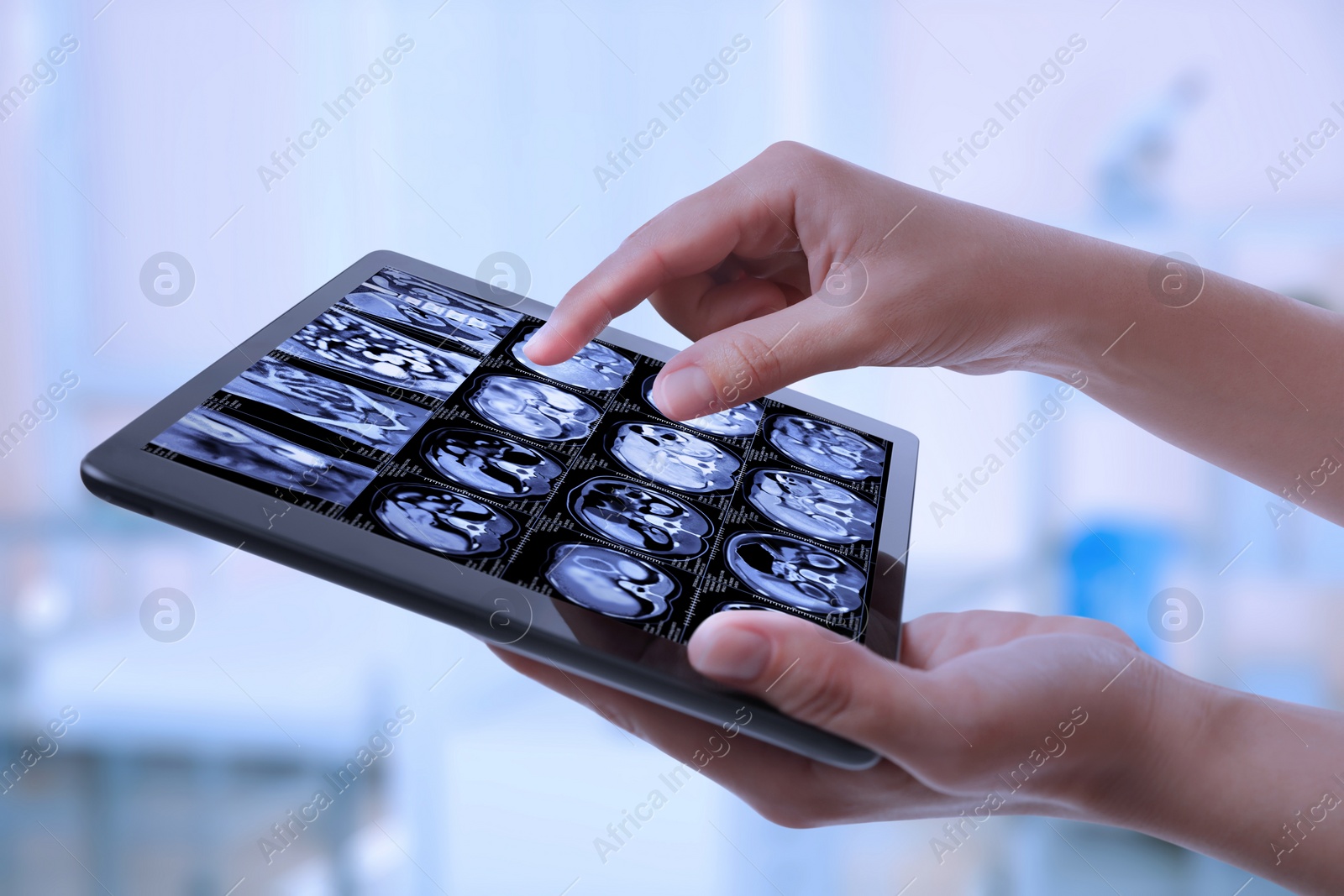 Image of Doctor examining x-ray images on tablet indoors, closeup