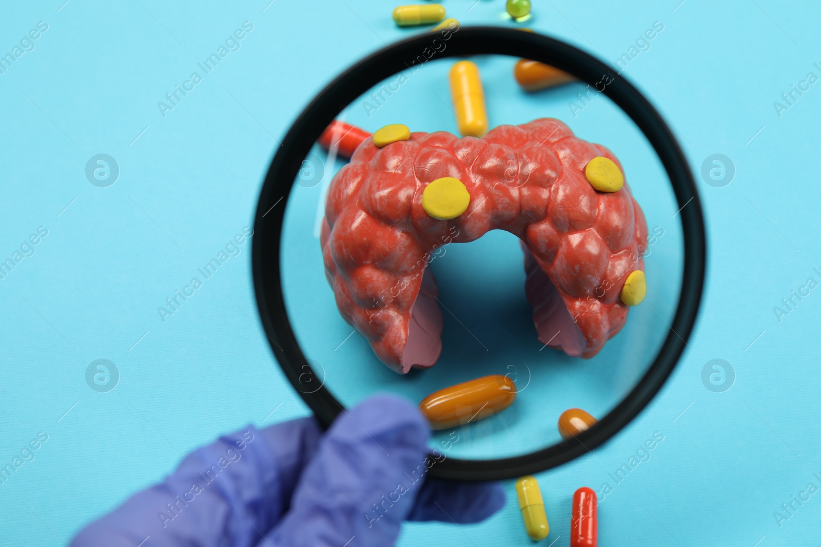 Photo of Endocrinologist looking at model of thyroid gland and capsules through magnifying glass on light blue background, closeup