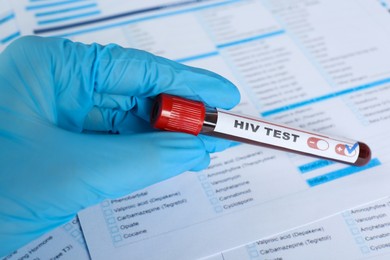 Photo of Scientist holding tube with blood sample and label HIV Test against laboratory form, closeup