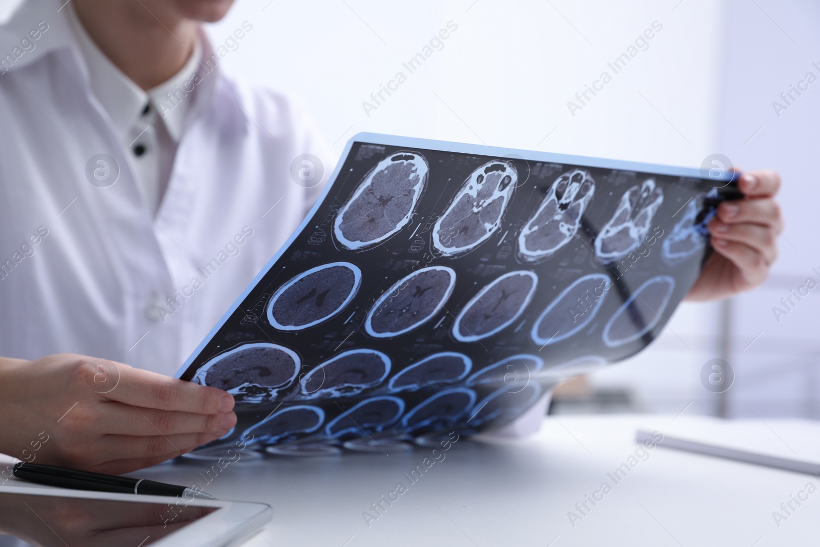 Photo of Doctor examining MRI images of patient with multiple sclerosis at table in clinic, closeup