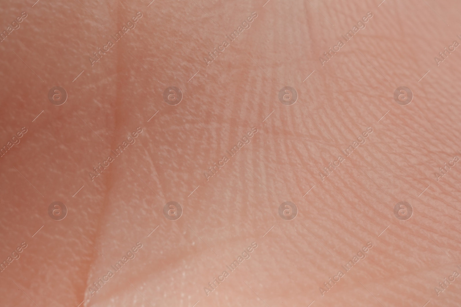 Photo of Texture of dry skin as background, macro view