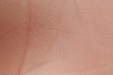 Photo of Texture of dry skin as background, macro view