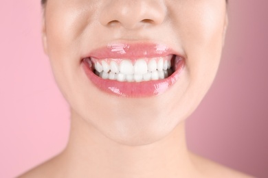 Beautiful young woman with healthy teeth on color background, closeup