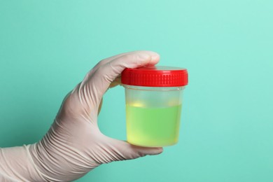Photo of Doctor holding container with urine sample for analysis on turquoise background, closeup