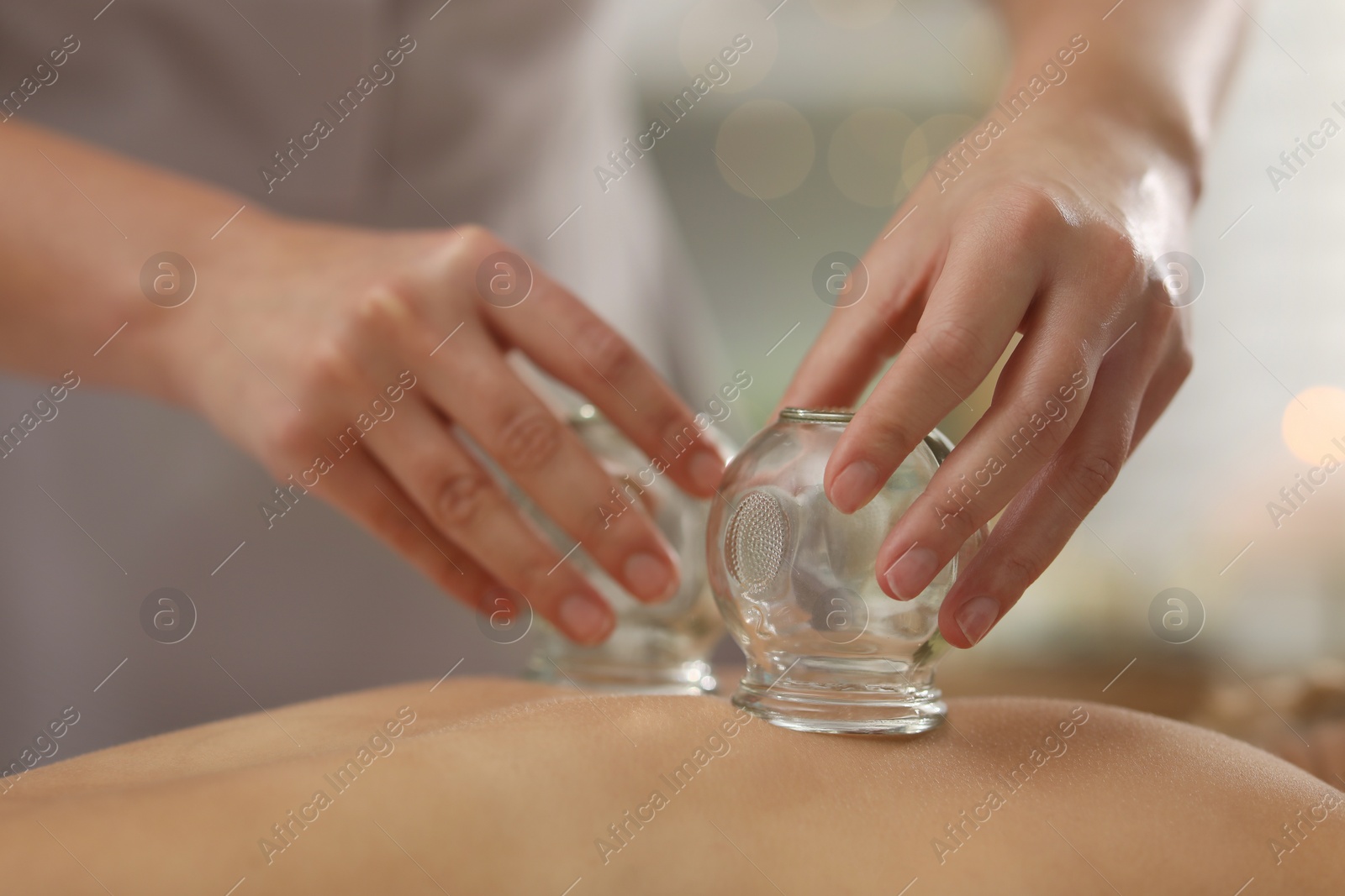 Photo of Therapist giving cupping treatment to patient indoors, closeup