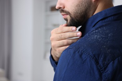 Photo of Man brushing dandruff off his shirt indoors, closeup. Space for text