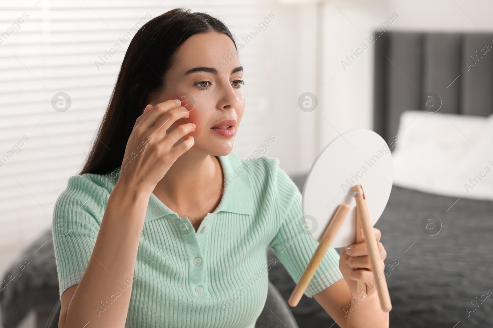 Photo of Suffering from allergy. Young woman looking in mirror and scratching her face in bedroom