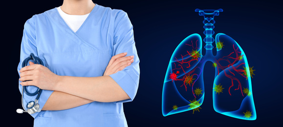 Image of Pulmonologist and lungs infected with coronavirus illustration on dark blue background, banner design