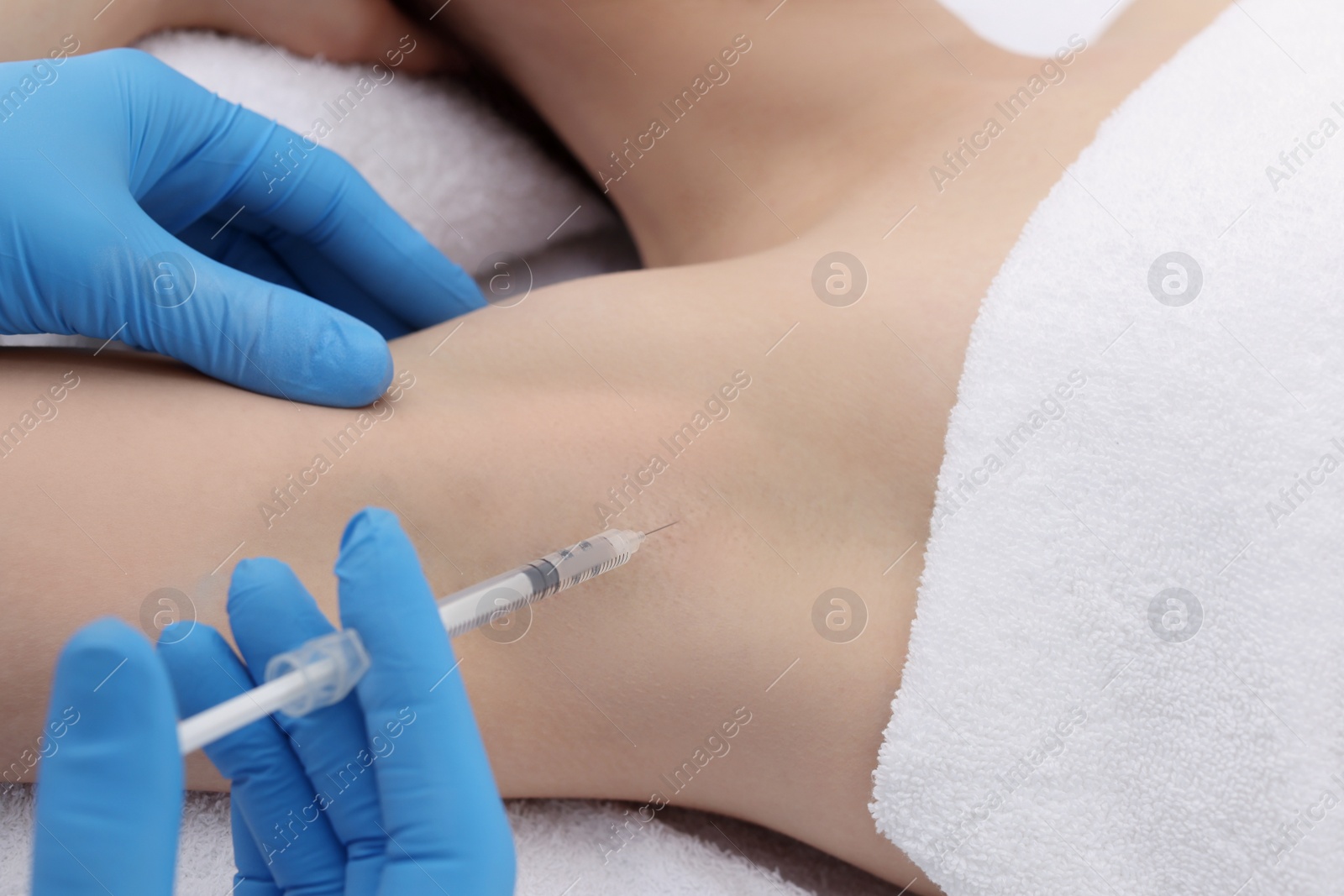 Photo of Cosmetologist injecting young woman's armpit, closeup. Treatment of hyperhidrosis