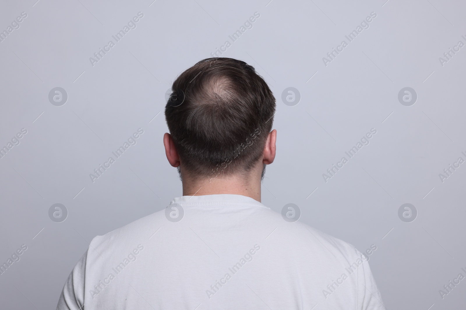 Photo of Baldness concept. Man with bald spot on light grey background, back view