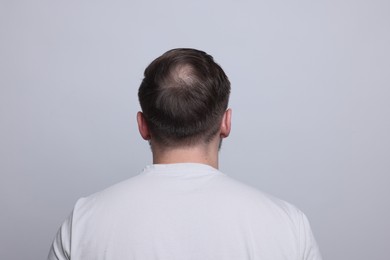 Baldness concept. Man with bald spot on light grey background, back view