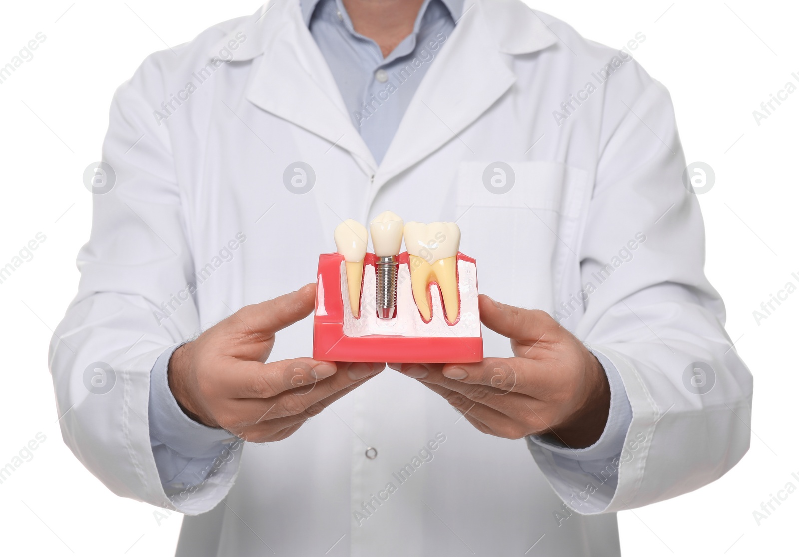 Photo of Dentist holding educational model of dental implant on white background, closeup