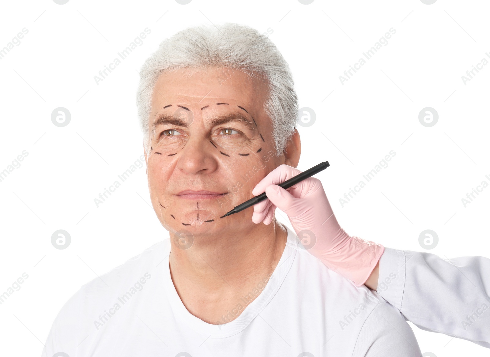 Photo of Doctor drawing marks on mature man's face for cosmetic surgery operation against white background