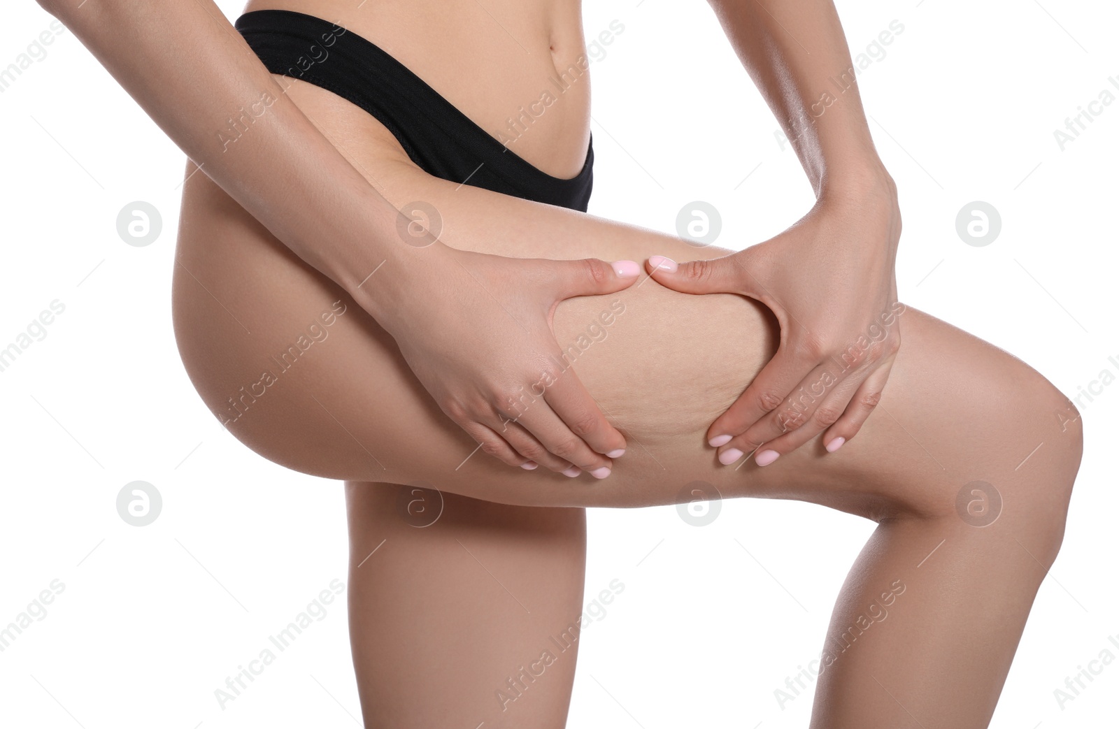 Photo of Closeup view of slim woman in underwear on white background. Cellulite problem concept