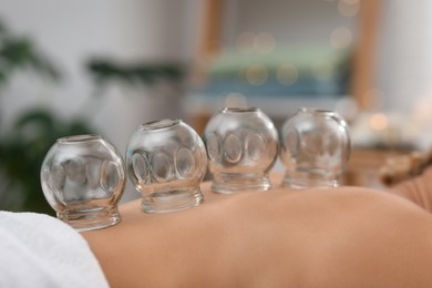 Photo of Cupping therapy. Closeup view of woman with glass cups on her back indoors