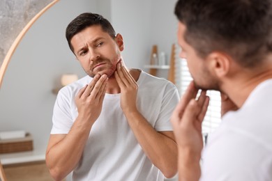 Photo of Man suffering from allergy looking at his skin in mirror indoors