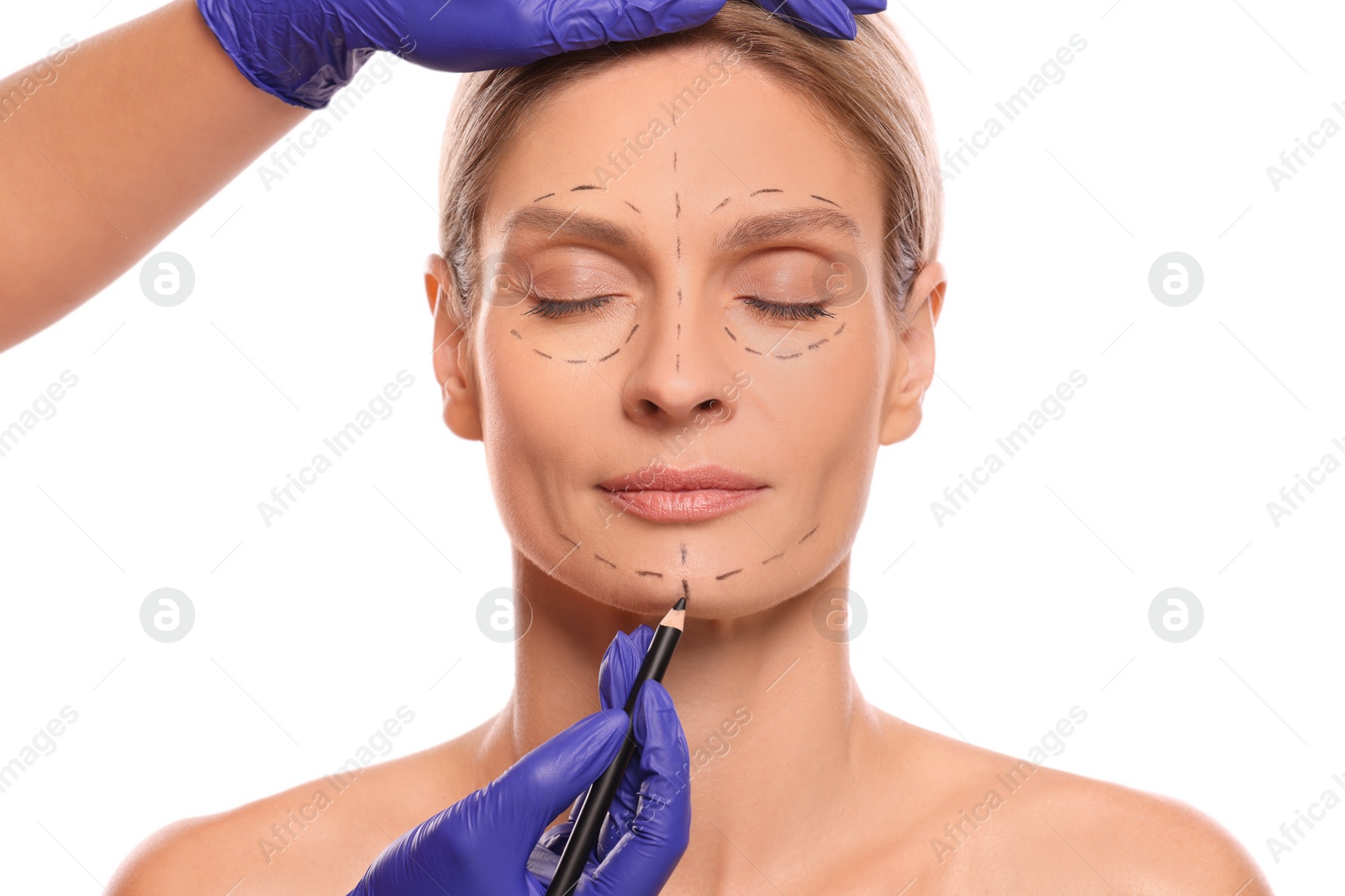 Photo of Doctor with pencil preparing patient for cosmetic surgery operation on white background, closeup