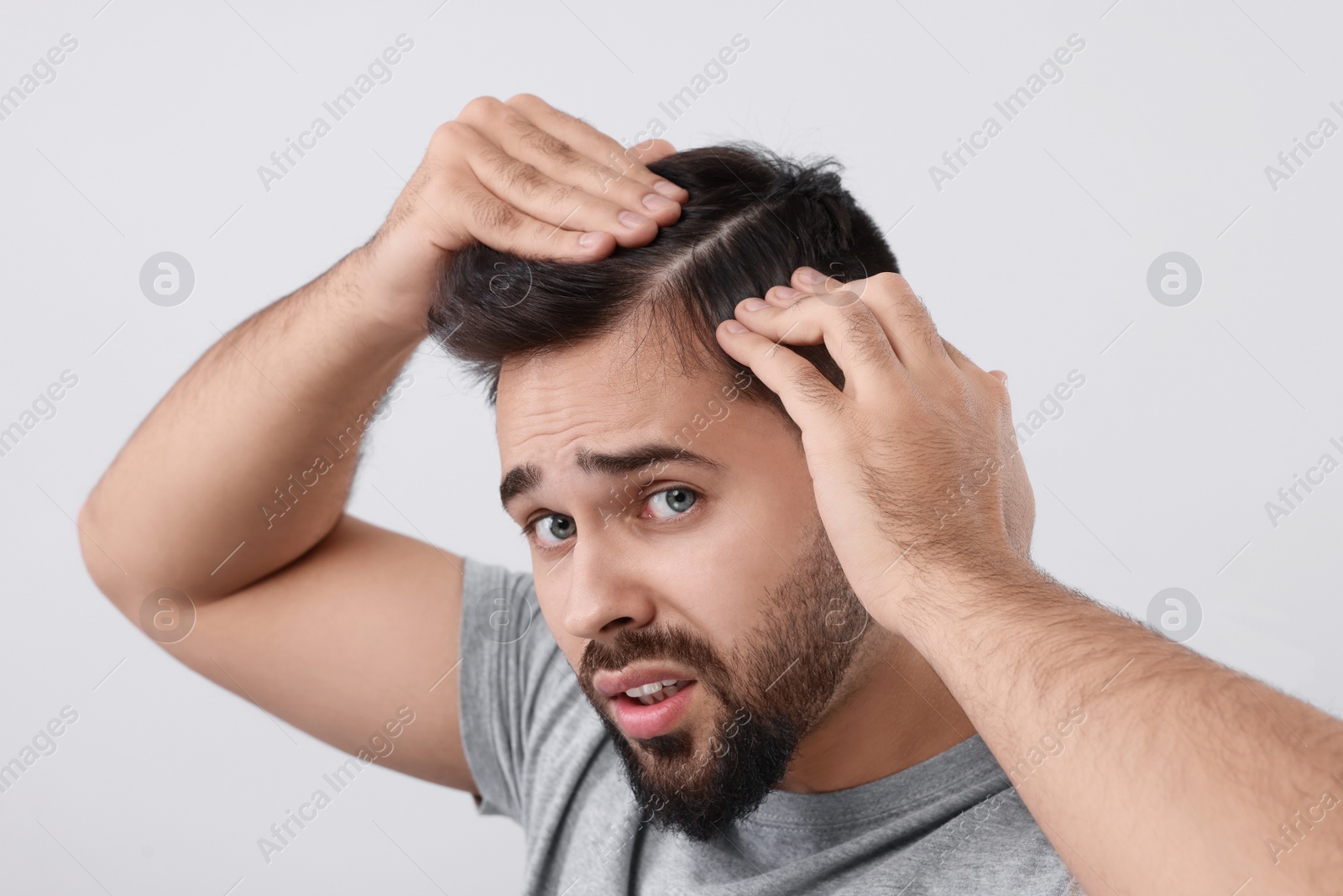 Photo of Emotional man examining his head on light grey background. Dandruff problem