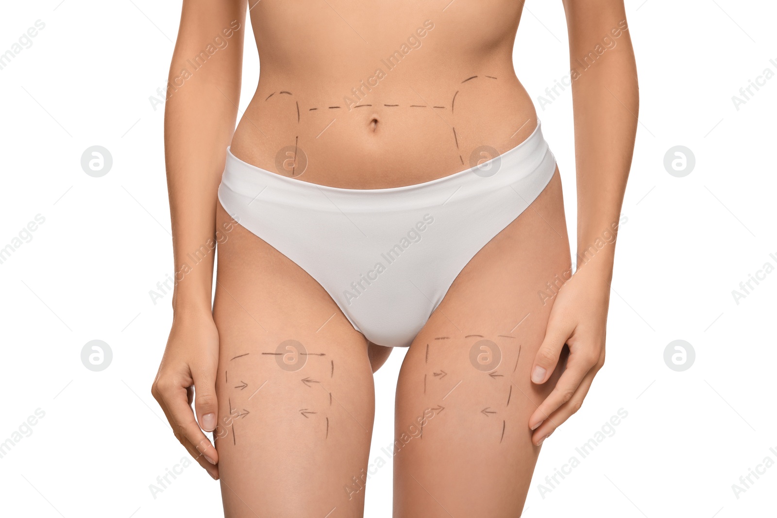 Photo of Slim woman with markings on body before cosmetic surgery operation on white background, closeup