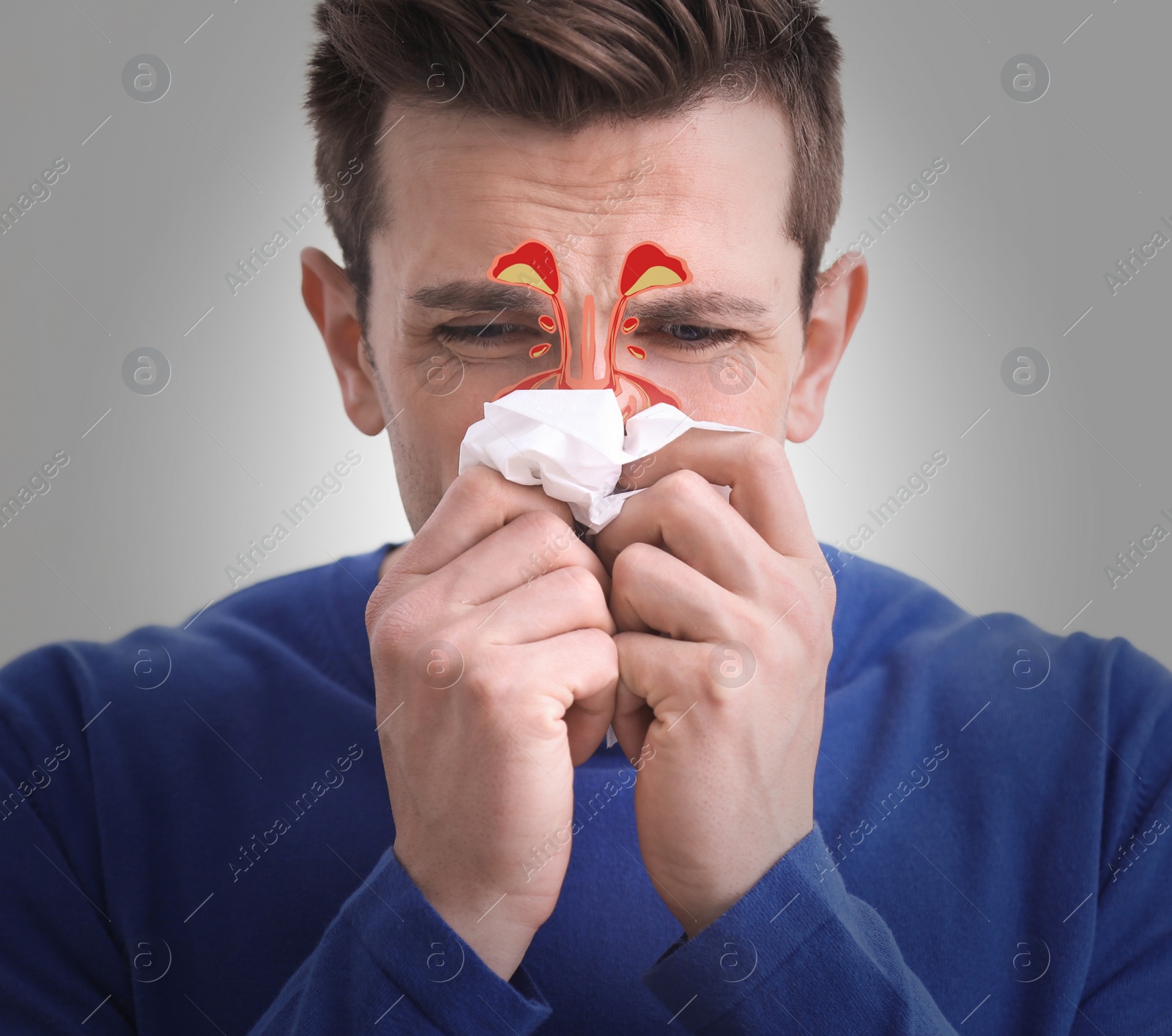 Image of Man suffering from runny nose as allergy symptom. Sinuses illustration on face