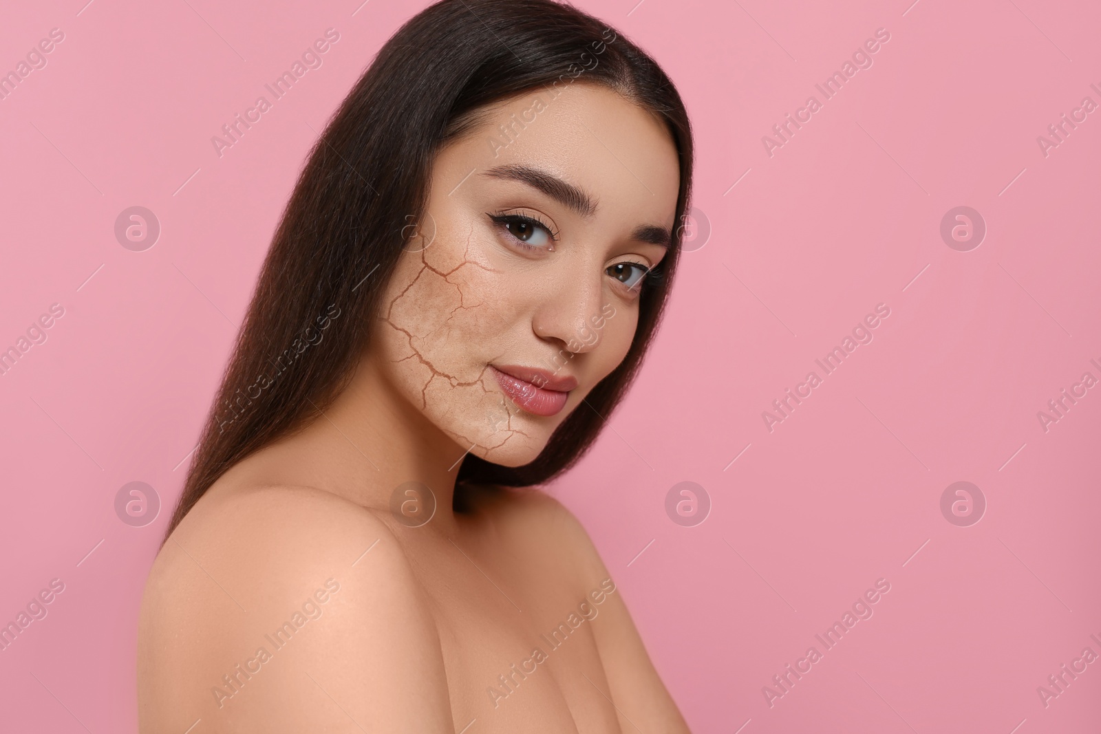 Image of Beautiful young woman with dry skin on pink background. Space for text