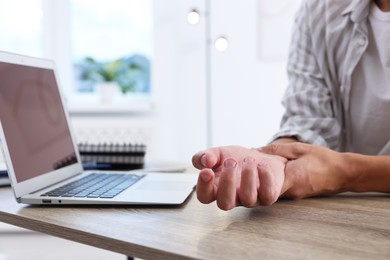 Photo of Man suffering from pain in wrist while working on laptop at table indoors, closeup. Carpal tunnel syndrome