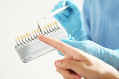 Photo of Doctor and patient choosing shade on teeth color palette in clinic, closeup. Dental veneers