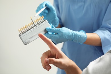 Photo of Doctor and patient choosing shade on teeth color palette in clinic, closeup. Dental veneers