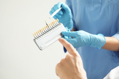 Doctor and patient choosing shade on teeth color palette in clinic, closeup. Dental veneers