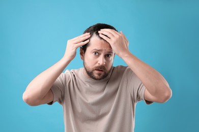 Man with hair loss problem on light blue background, space for text