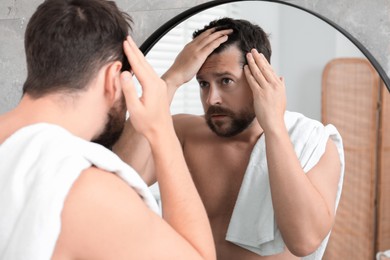 Photo of Man with hair loss problem looking at mirror indoors