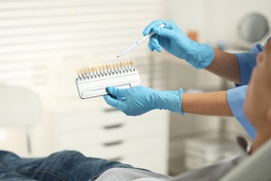 Doctor and patient choosing shade on teeth color palette in clinic, closeup. Dental veneers