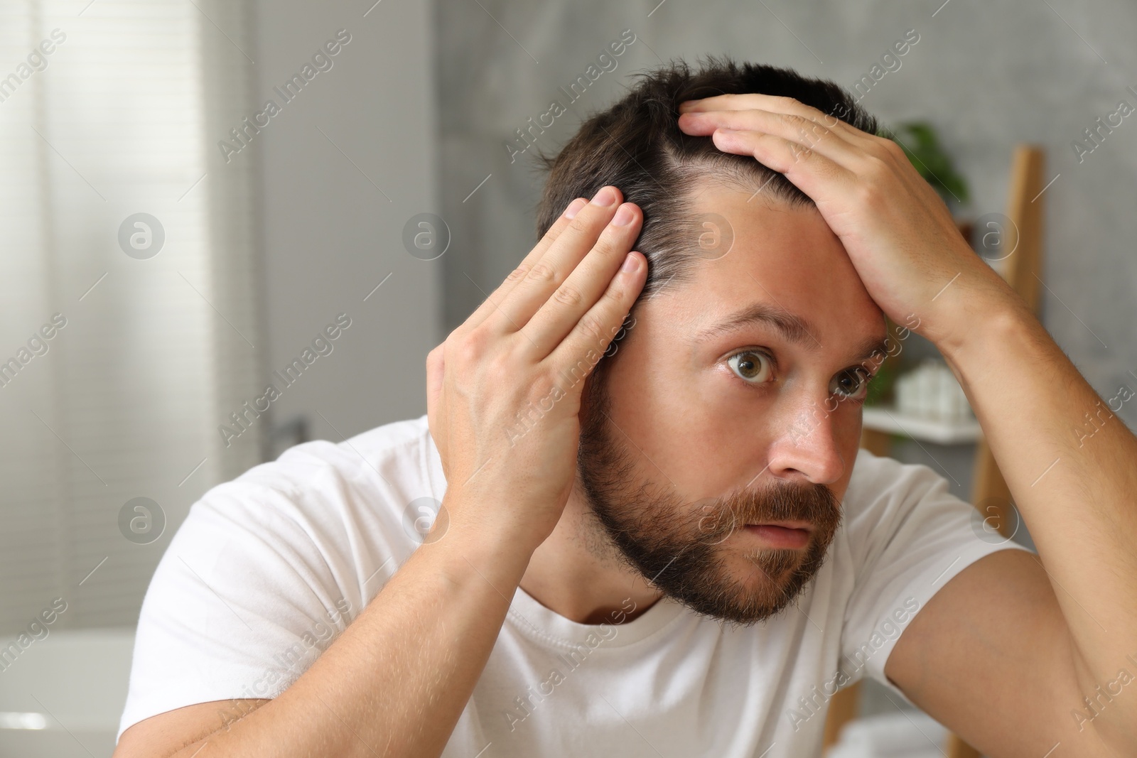 Photo of Man with hair loss problem looking at mirror indoors