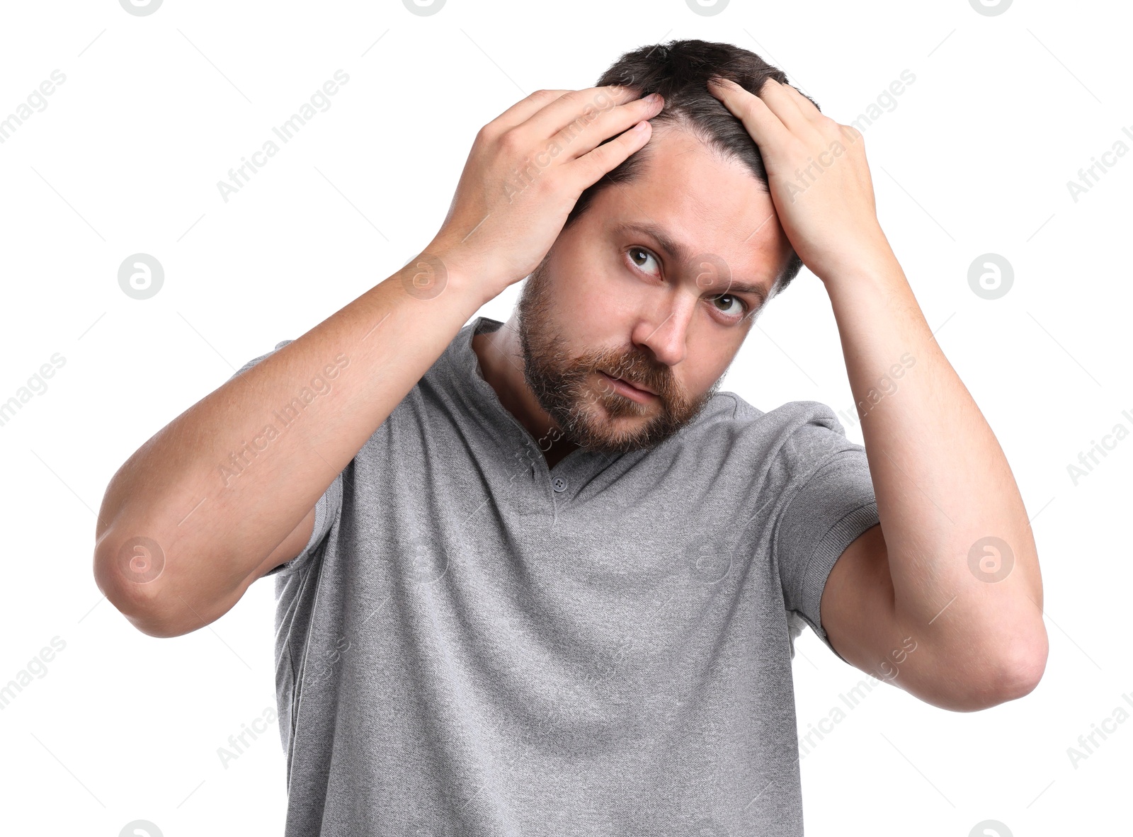 Photo of Man with hair loss problem on white background