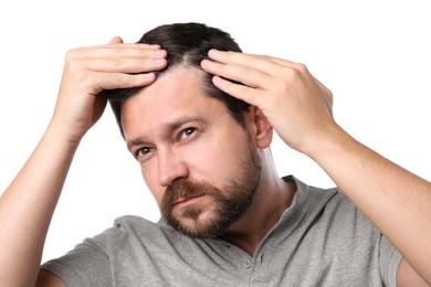 Man with hair loss problem on white background