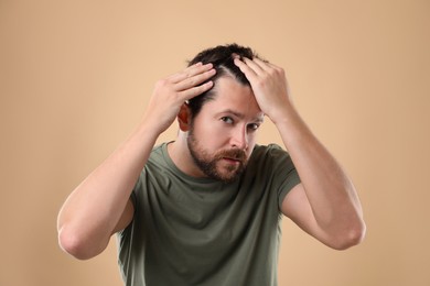 Photo of Man with hair loss problem on beige background