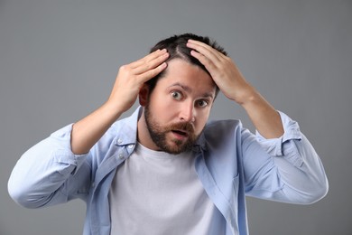 Photo of Man with hair loss problem on gray background