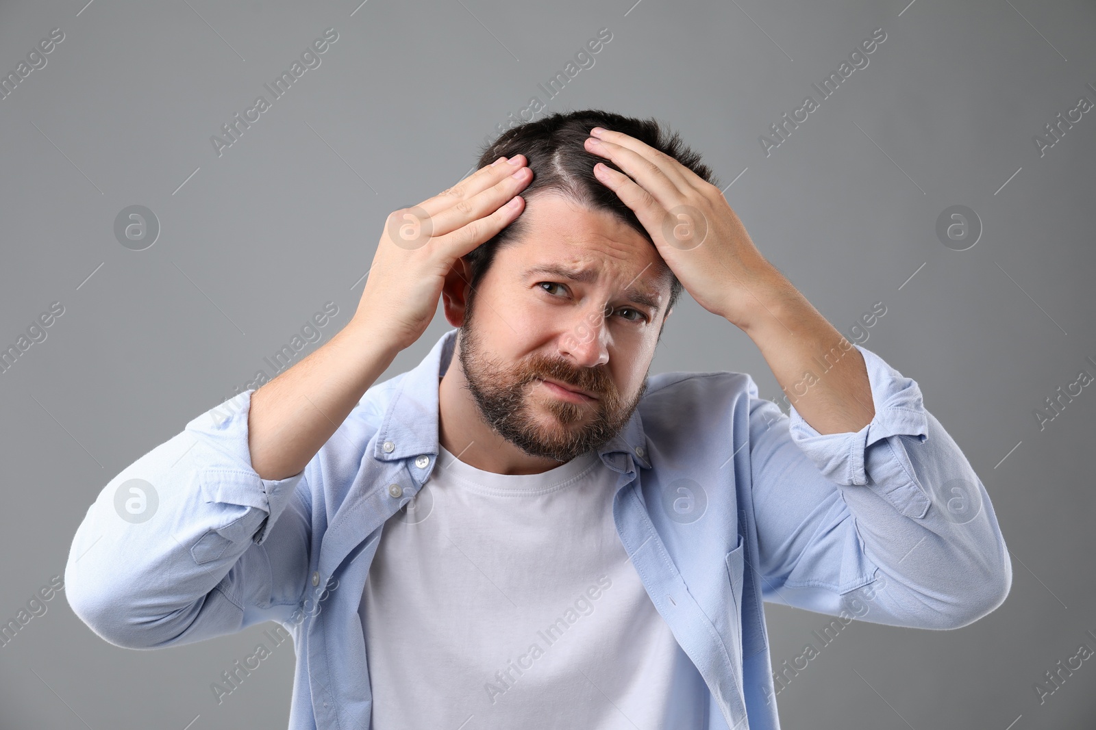 Photo of Man with hair loss problem on gray background