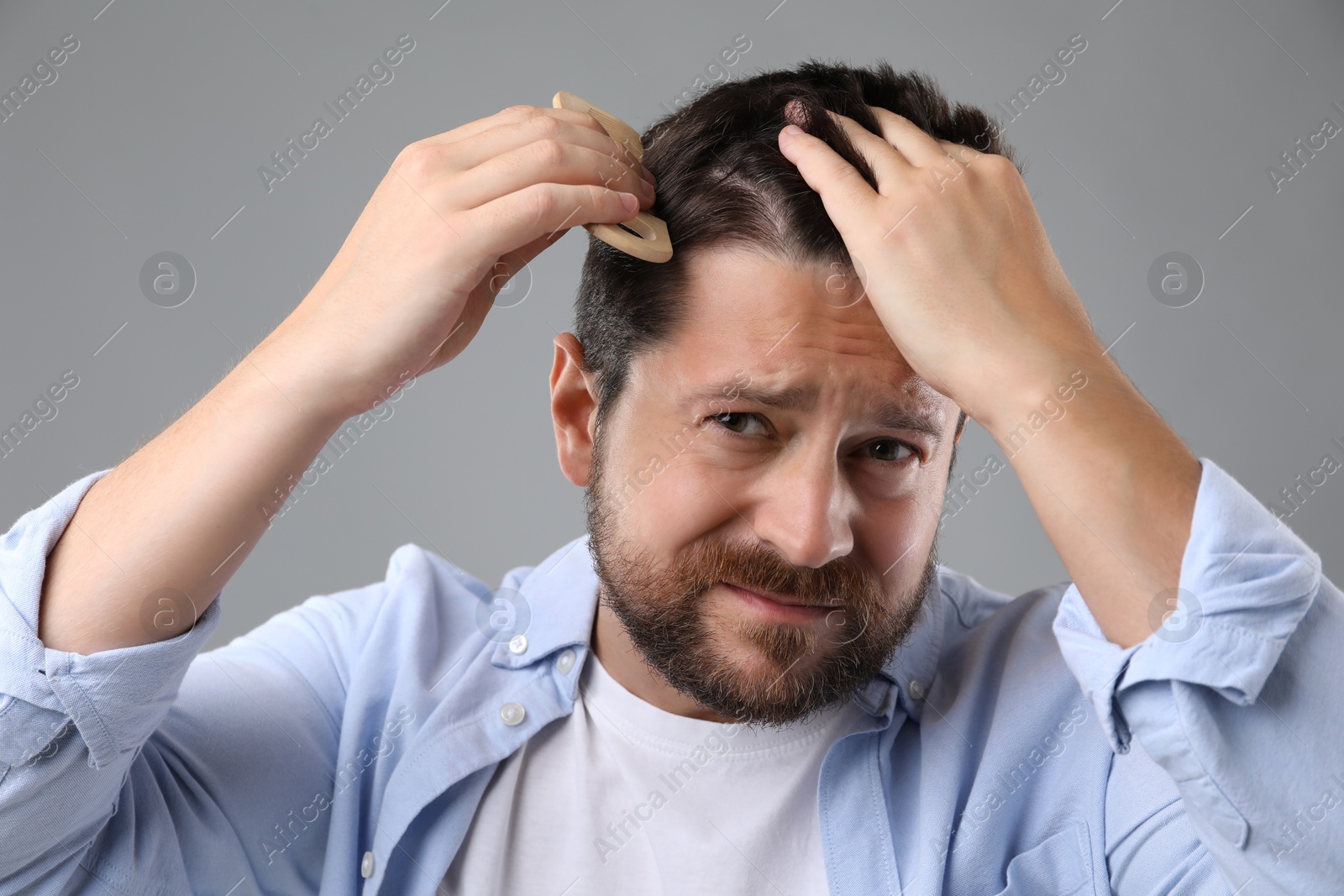 Photo of Man brushing his hair on gray background. Alopecia problem