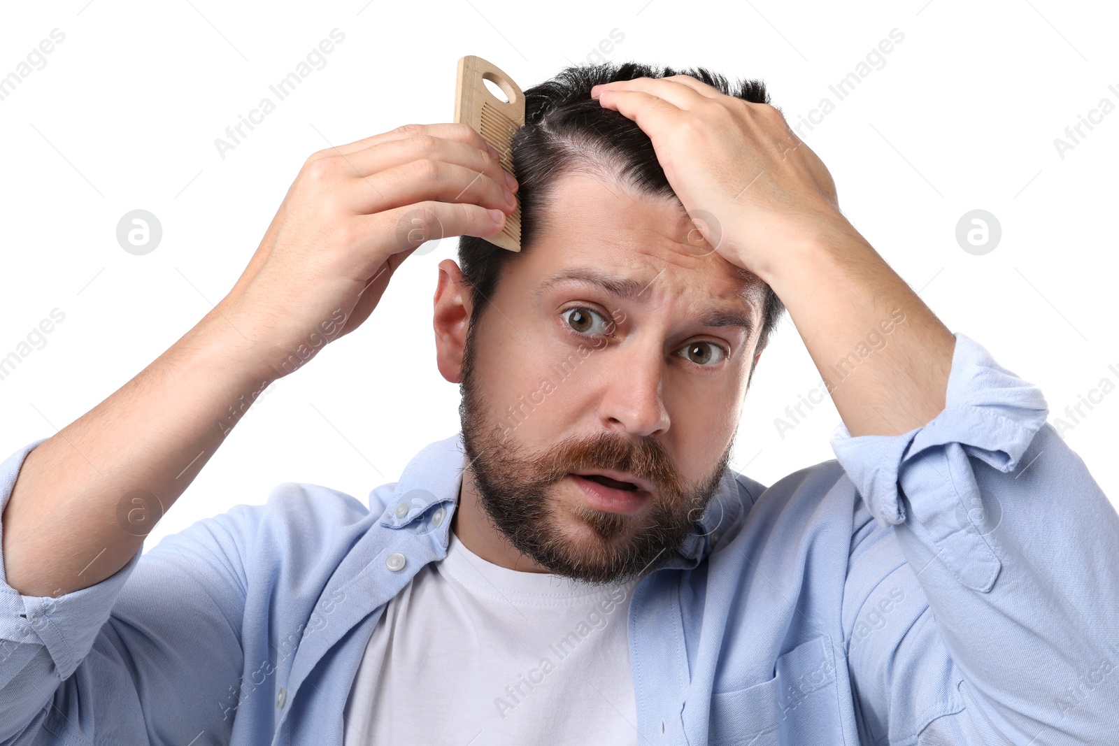 Photo of Man brushing his hair on white background. Alopecia problem