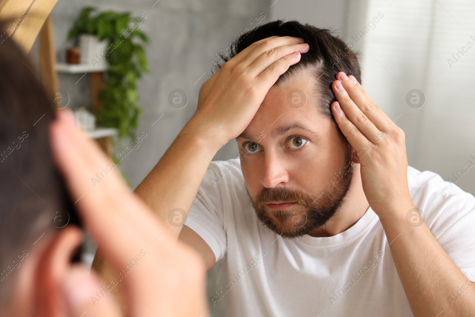 Photo of Man with hair loss problem looking at mirror indoors