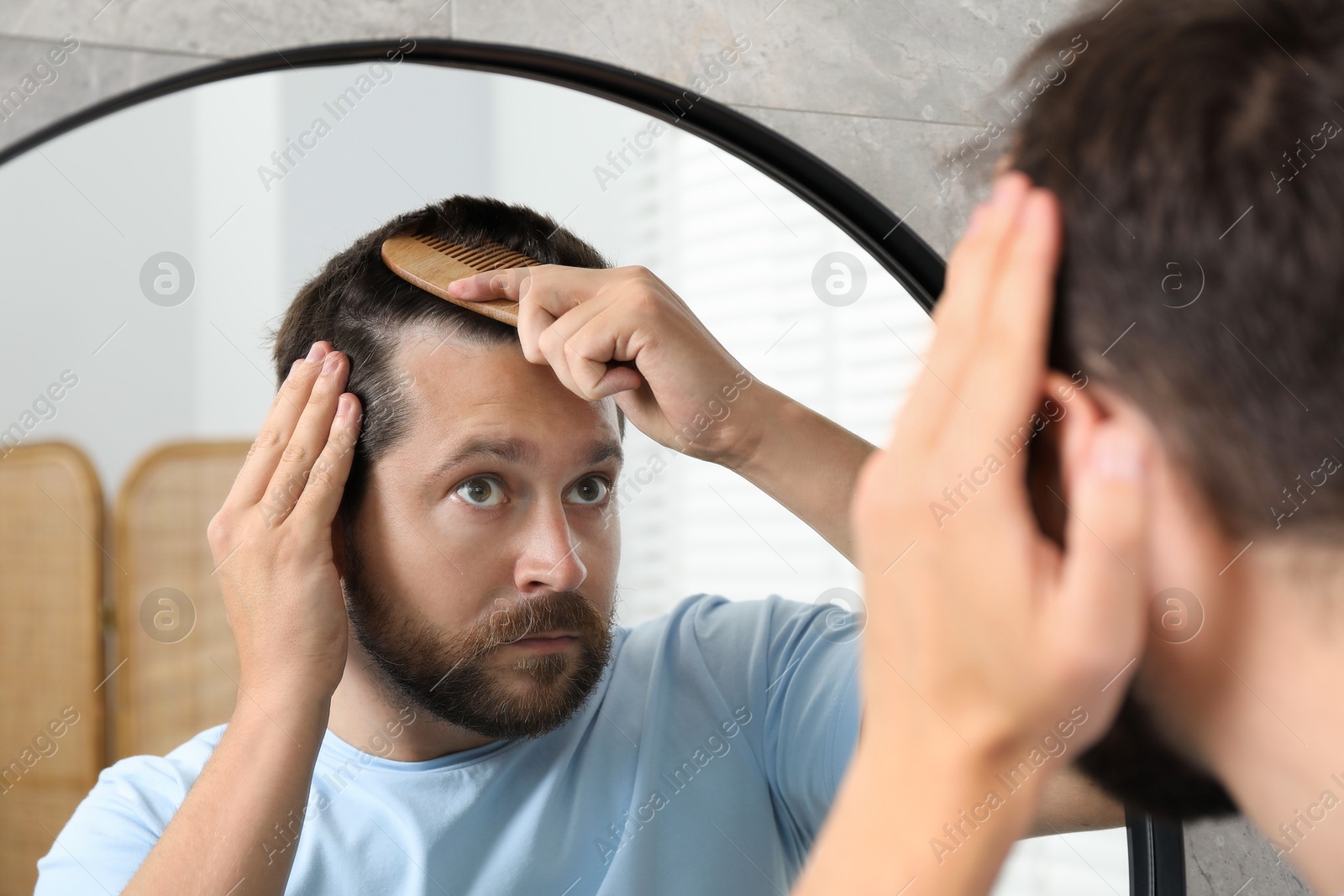 Photo of Man brushing his hair near mirror indoors. Alopecia problem