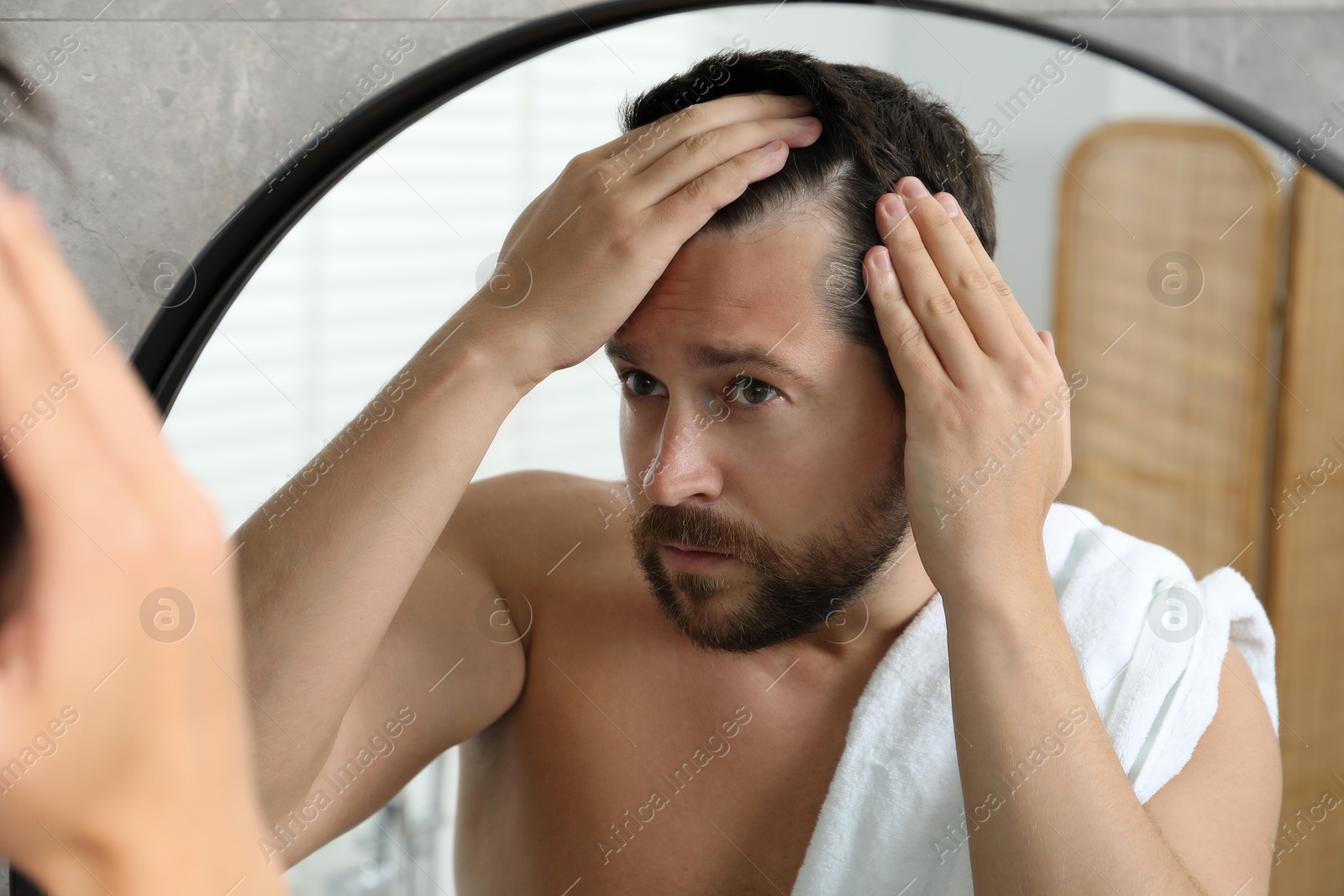 Photo of Man with hair loss problem looking at mirror indoors