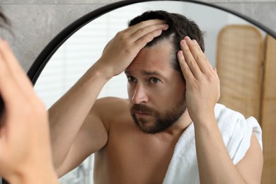 Photo of Man with hair loss problem looking at mirror indoors