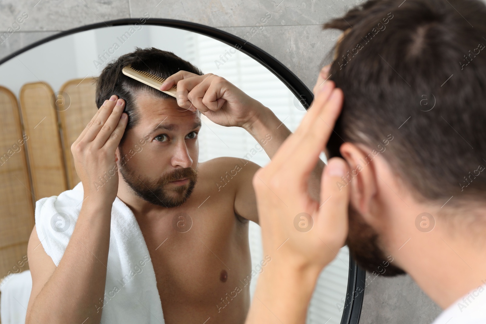 Photo of Man brushing his hair near mirror indoors. Alopecia problem