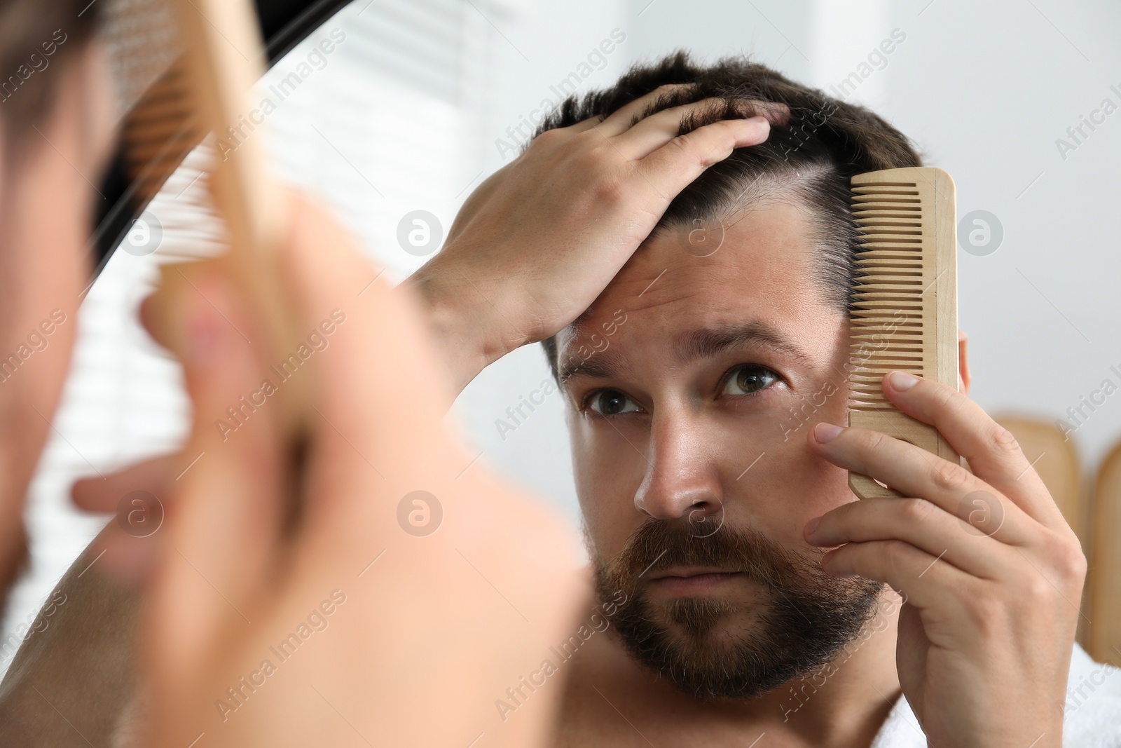 Photo of Man brushing his hair near mirror indoors. Alopecia problem