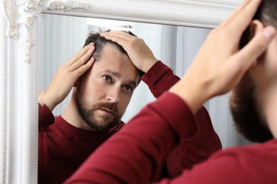 Photo of Man with hair loss problem looking at mirror indoors